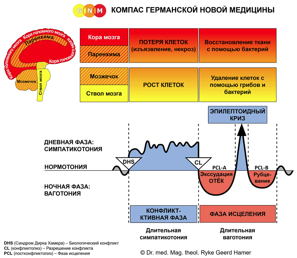 Болезнь? Это всего лишь симптом – разбор Новой Медицины